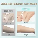 At Home IPL Hair Removal Device with Lasting Results, Permanent Hair Reduction, 5 Energy Levels, Skin Tone Sensor, Flash Mode, and Cordless Design for Face and Body - Image 4