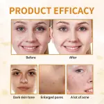 7% Glycolic Acid Exfoliating Toner – Pore Minimizing, Smooth Skin, Even Tone - Image 2